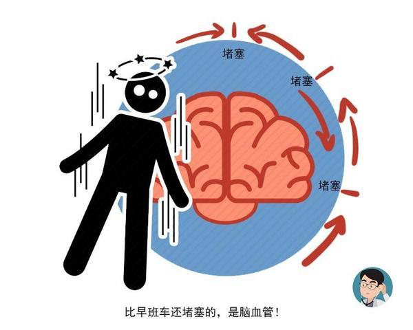 腦中風發作前的四個癥狀 謹防中風猝死 腦中風發作前的四個癥狀 謹防中風猝死