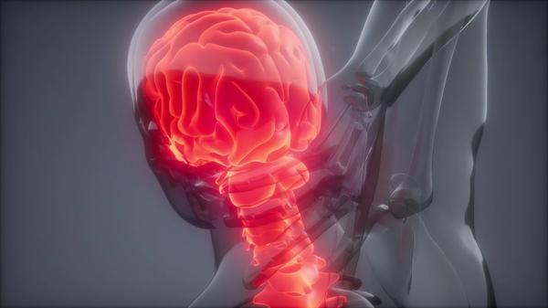 腦出血發生時的癥狀 發病突然致殘率高 腦出血發生時的癥狀 發病突然致殘率高