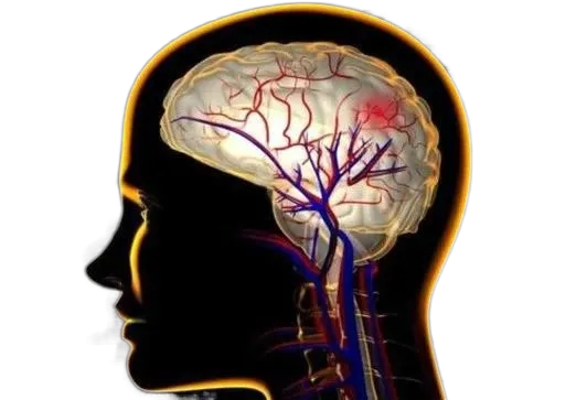彩色經顱多普勒超聲TCD：檢測腦血管血流情況